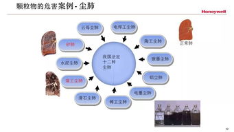 放射安全防護知識ppt