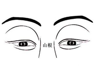 山根的典故