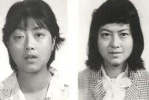 測試甲亢方法有哪些