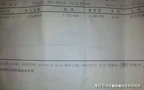 hp18陽(yáng)性的治療方法有哪些