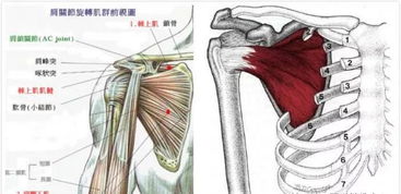 肩周炎自我的治療方法有哪些