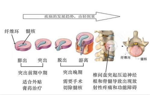 治療頭汗的方法有哪些