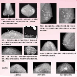 深部觸診法包括哪些簡(jiǎn)述其觸診方法及臨床意義