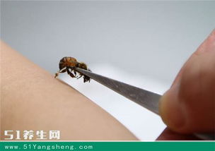蜂療方法都可以治療哪些疾病