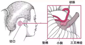 治療神經(jīng)的方法有哪些