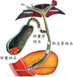 對膽的檢查有哪些方法