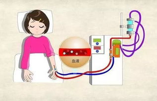 肌酐高的中醫治療方法有哪些