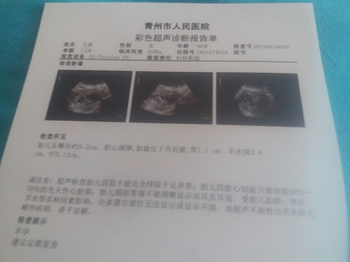 避免出現宮縮的方法有哪些
