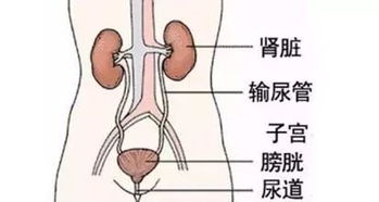 尿路感染做哪些治療方法