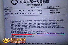 b超檢查報告單(B超檢查多少錢(qián))