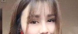 做完內(nèi)吸眼袋注意事項