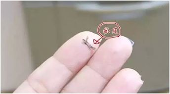 輕氧眉掉痂后注意事項