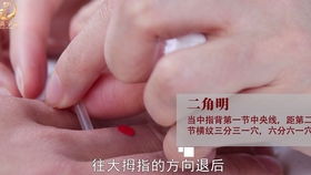 驗光,注意事項