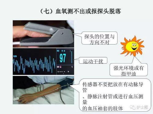 監護,注意事項,心電