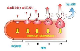 檢查大便之前注意事項,嬰兒檢查大便常規(guī)注意事項,大便隱血檢查注意事項