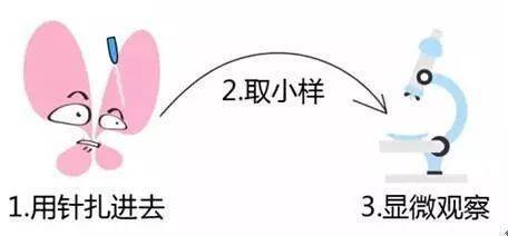 男性hpv檢查前注意事項,男性檢查HPV注意事項,HpV檢查注意事項