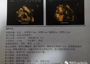 四維注意事項