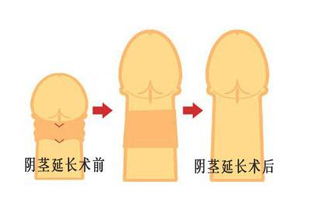 做手術(shù)前注意事項,做手術(shù)后注意事項,做了手指手術(shù)注意事項