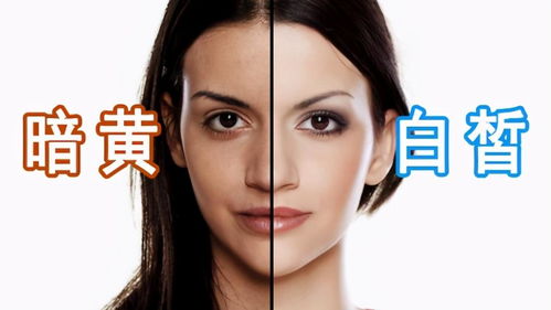 臉過(guò)完敏是不是以后都要注意事項(xiàng)
