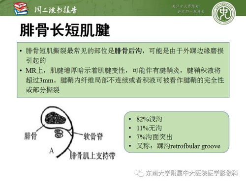 注意事項