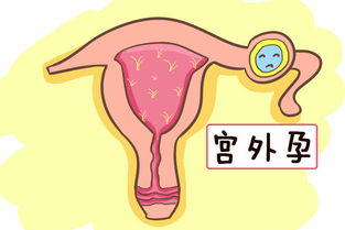 早孕見紅注意事項