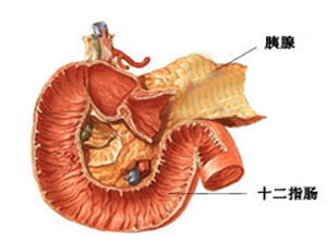 胰腺癌術(shù)后飲食注意事項,胰腺腫瘤飲食注意事項,胰腺手術(shù)后注意事項
