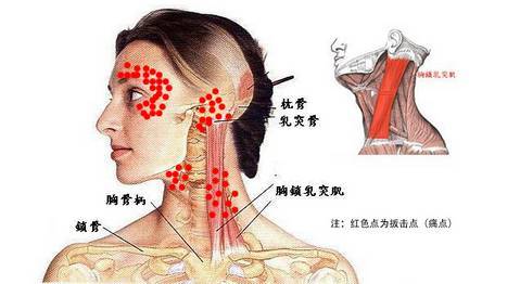 頸椎做完正骨手法后注意事項