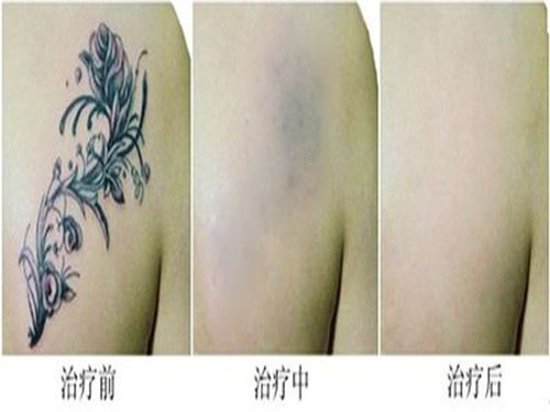 洗紋身以后注意事項