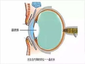 脖子做完手術(shù)后怎么注意事項