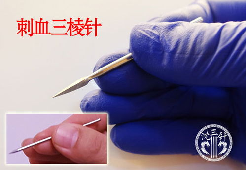 舌根放血后注意事項(xiàng),放血后注意事項(xiàng)不能吃,針灸放血后注意事項(xiàng)
