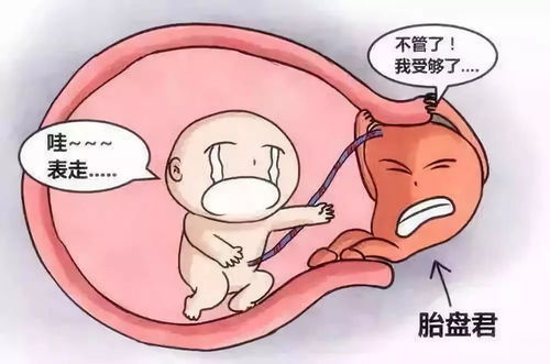 32周胎盤(pán)前置注意事項