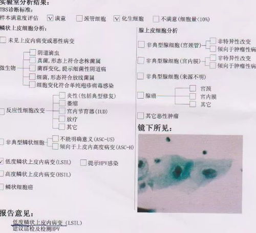 標本,注意事項,TCT