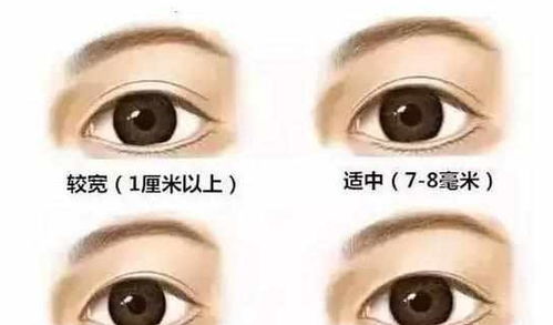 割雙眼皮睡覺(jué)注意事項(xiàng)