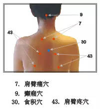 瀉血排瘀的注意事項,瀉血后注意事項,抽完血后注意事項