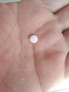蕁麻疹,小兒,注意事項(xiàng)