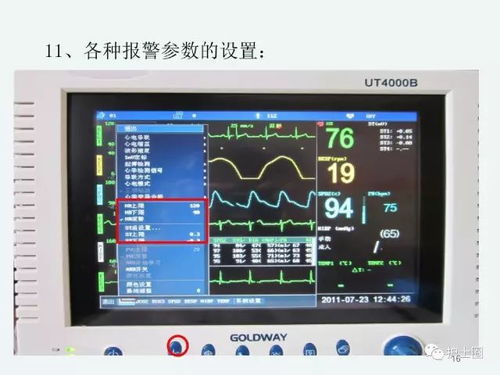 心電監(jiān)護(hù)儀使用注意事項(xiàng)