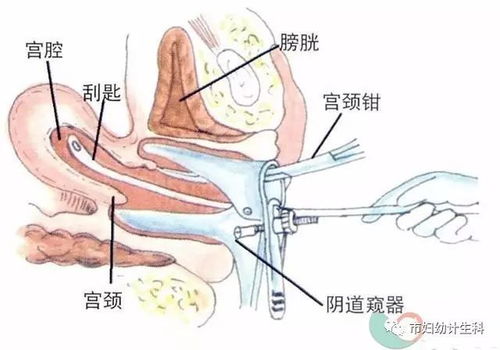 做無痛人流前需要注意什么,做無痛人流手術(shù)前需要注意什么,無痛人流手術(shù)前注意事項有哪些