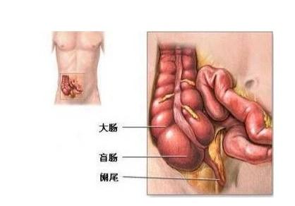闌尾炎微創(chuàng)手術(shù)后注意事項(xiàng),闌尾炎吊水好了以后注意事項(xiàng),闌尾炎手術(shù)后注意事項(xiàng)和飲食