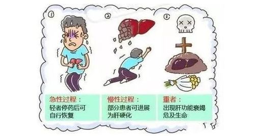 肝損傷恢復后注意事項
