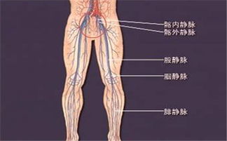 靜脈血栓形成注意事項