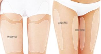 大腿內側抽脂注意事項
