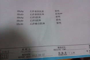 谷丙轉(zhuǎn)氨酶偏高注意事項(xiàng)