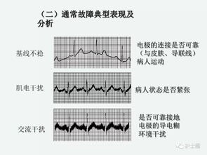 上心電監護的注意事項