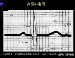 心電圖基礎知識講解,心電圖教學(xué)基礎知識,心電圖入門(mén)基礎知識
