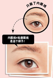 整形類(lèi)基礎知識