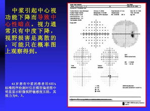 光學檢測類基礎知識