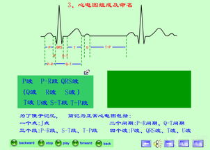 最新章節(jié)心電圖基礎(chǔ)知識(shí)1