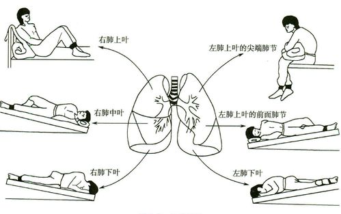 2018護(hù)士基礎(chǔ)護(hù)理知識