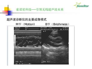 學(xué)b超基礎知識