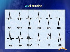 心電圖,基礎知識,護理,教學(xué)
